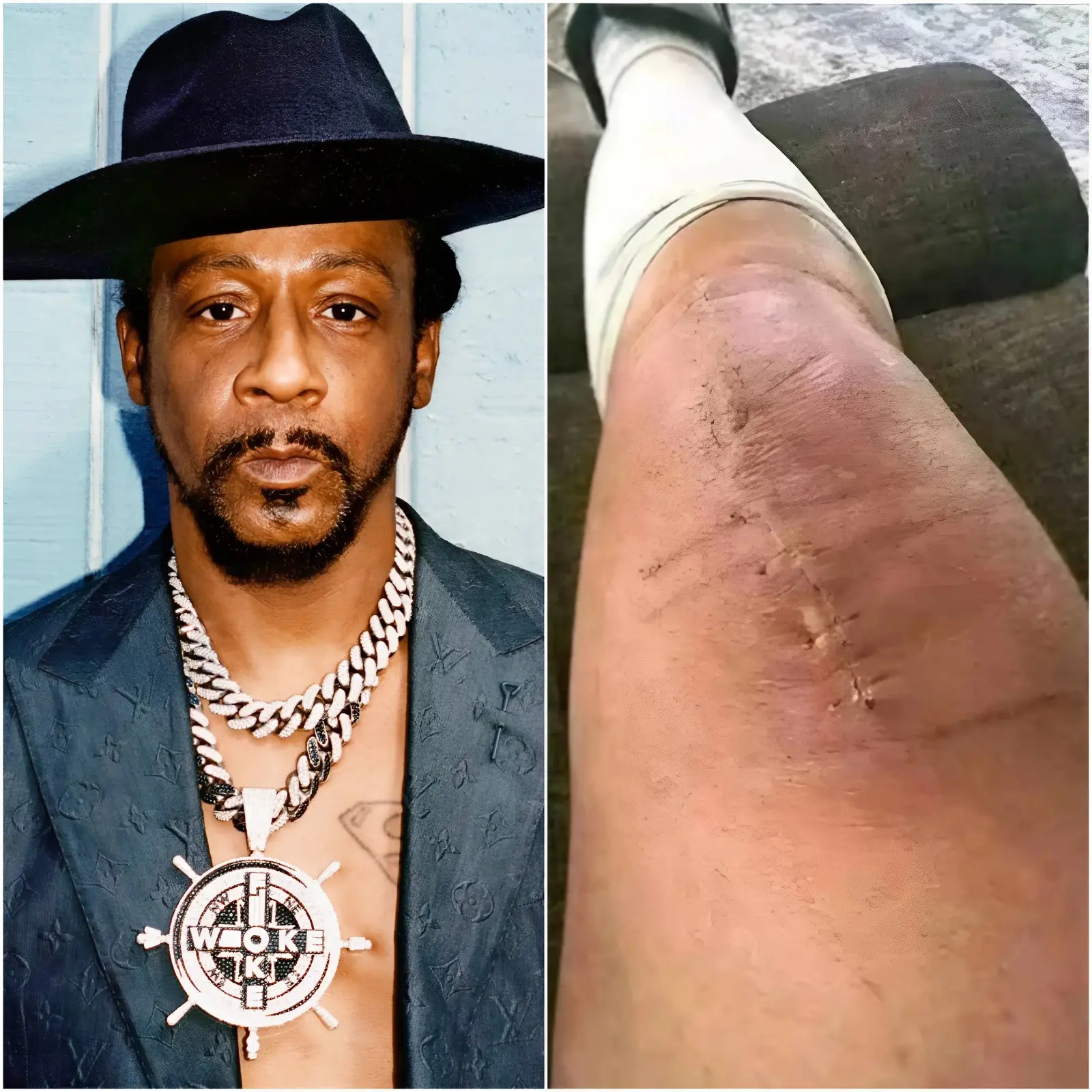 GOOD NEWS from Katt Williams: A heartfelt message after surgery 💬 “I still have a long road ahead. But I believe in healing — through love, through truth, and through the prayers from all of you.”
