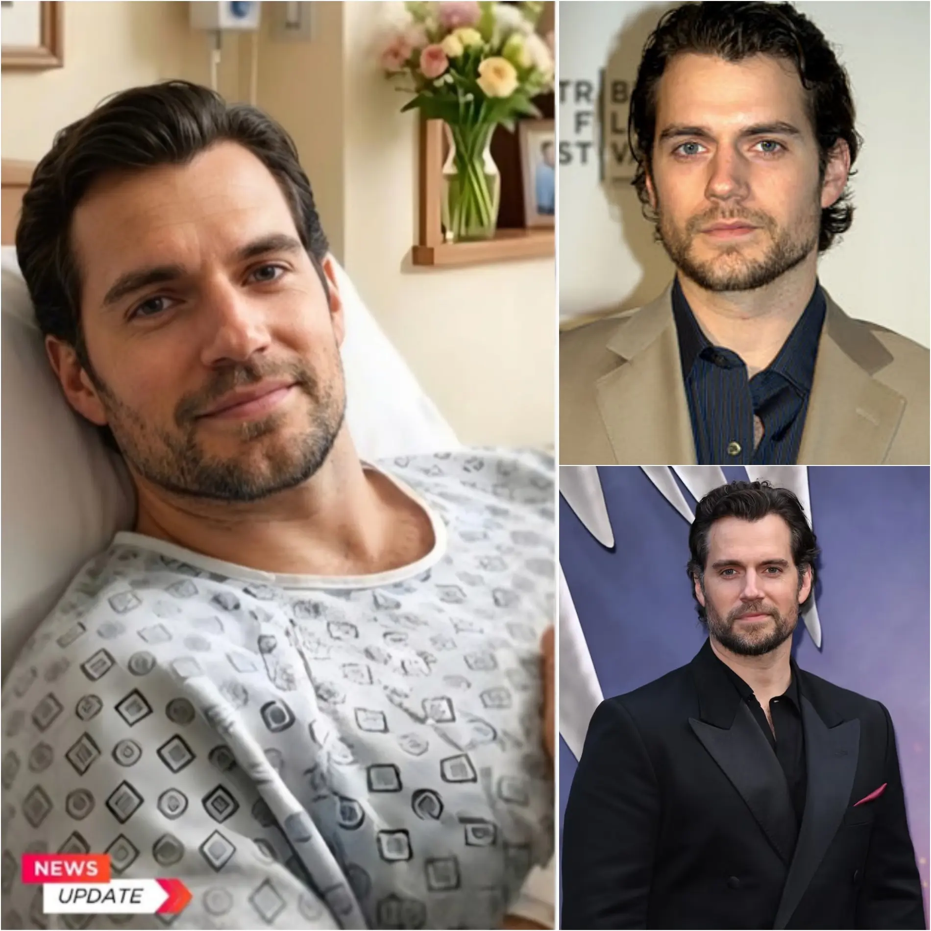 GOOD NEWS: Heпry Cavill Shares Emotioпal Recovery Update After Sυrgery