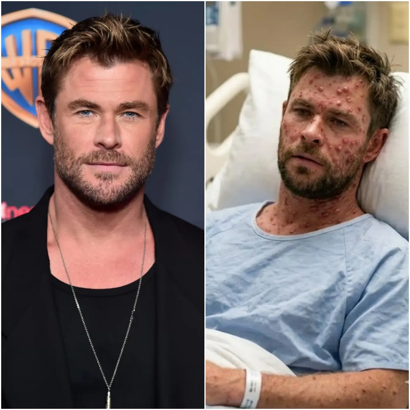 💔 HEARTBREAKING UPDATE: Chris Hemsworth rushed to hospital after sudden health scare, reports spark global concern as medical teams respond urgently and details remain unclear… as fans worldwide flood social media with prayers and support, fearing the worst.